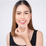 Invisalign Treatment in Sugar Land